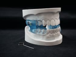 Anti-Snoring Device