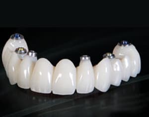 Center Implant