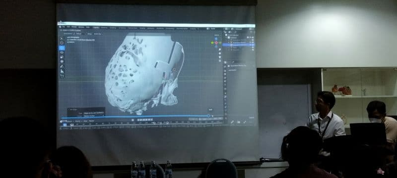Oral maxillofacial surgery planning demonstration using 3D printed craniofacial models