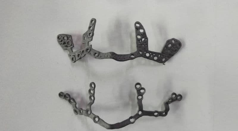 3D Gens ISO-accredited production of titanium and PEEK implants for neuro maxillofacial surgery