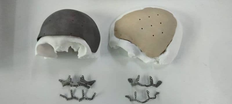 Experience the future of Neuro & maxillofacial surgery with our bespoke 3D printed implants, availab